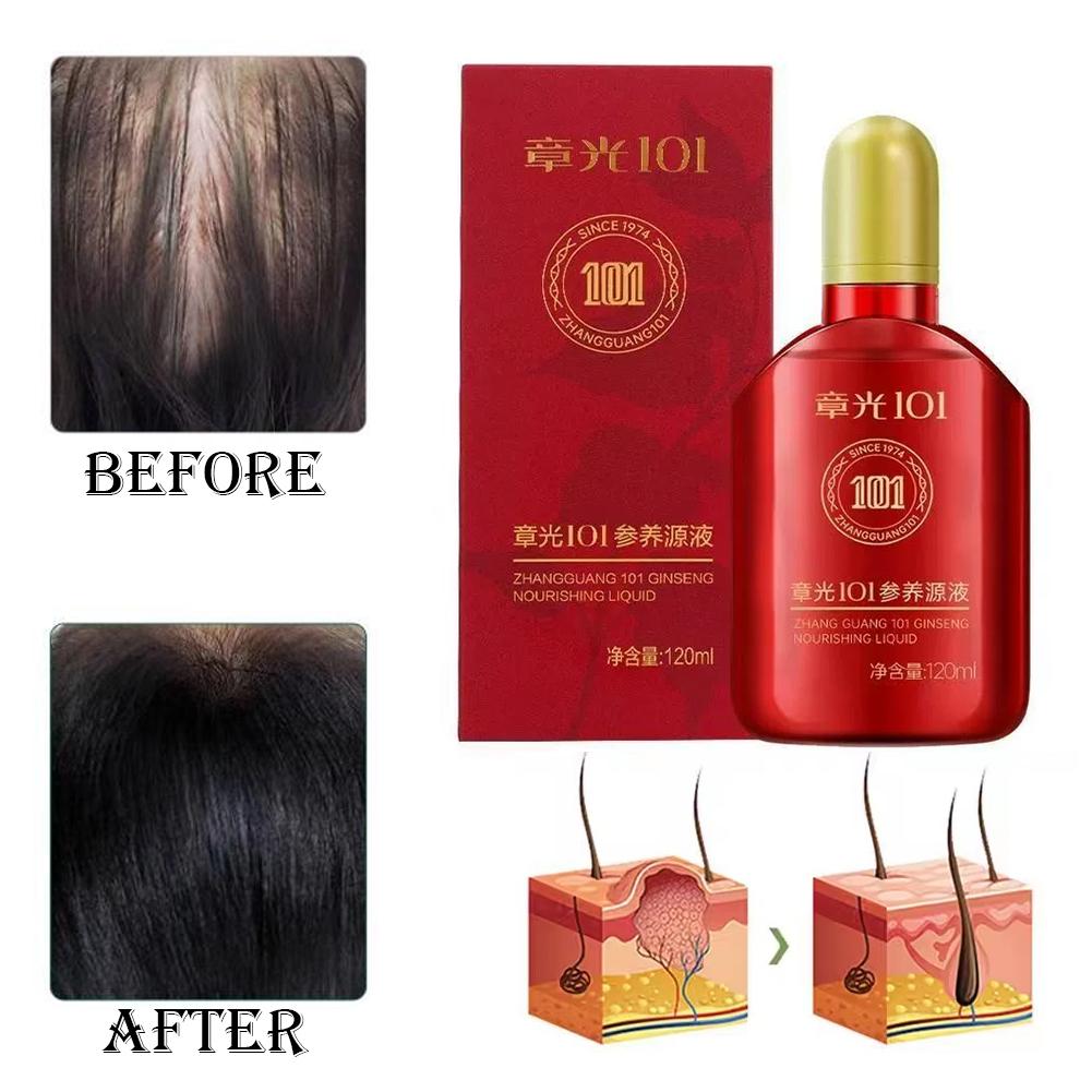 Zhang Guang 101 formula (101P) - Hair Care Normal 评论和价格