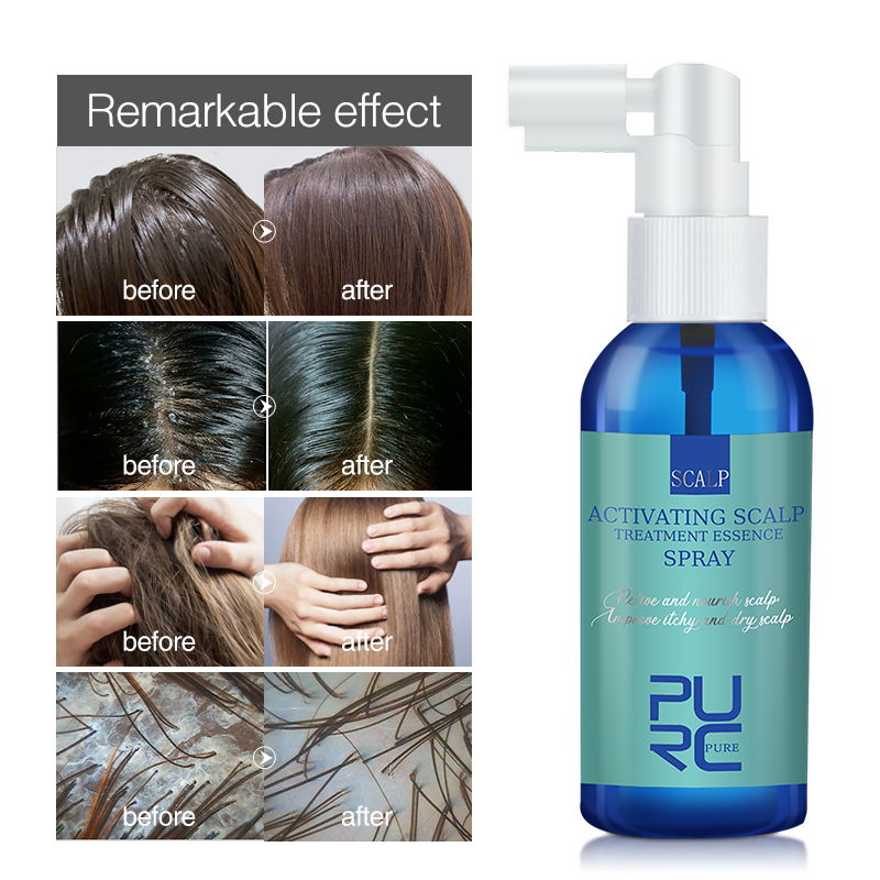 PURC Hair Scalp Treatment Esse - Hair Care Normal 评论和价格