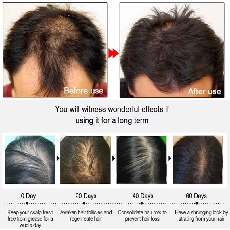 Fast Ginger Hair Growth Spray  - Hair Care Tonic 评论和价格